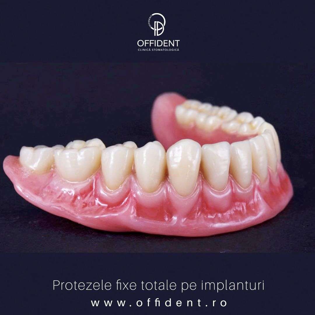 proteza dentara Cluj, protetica dentara Cluj